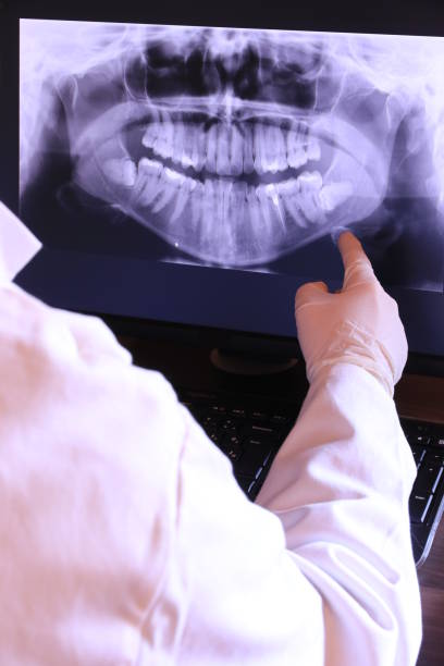 Best Emergency Root Canal Treatment in Tton, IL