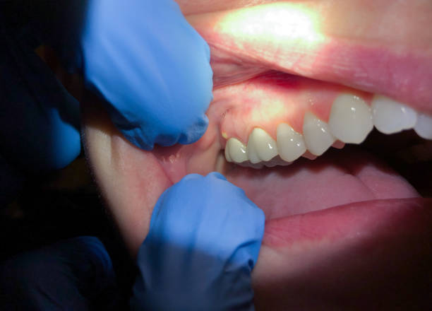 Best Pediatric Emergency Dentist in Tton, IL