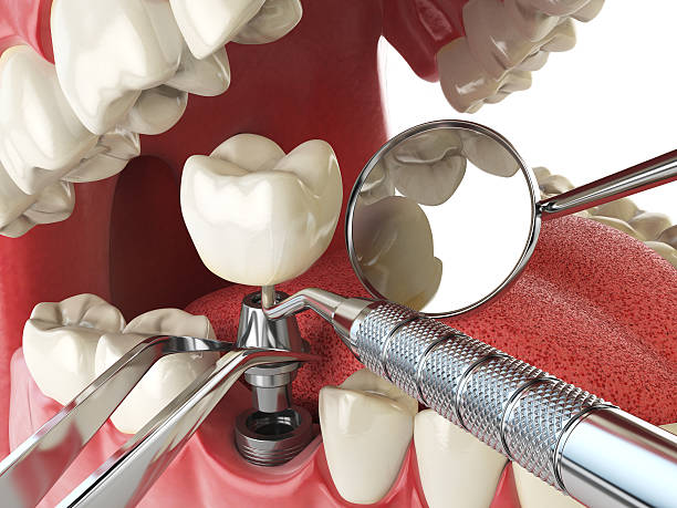 Best Emergency Dental Services for Seniors in Tton, IL